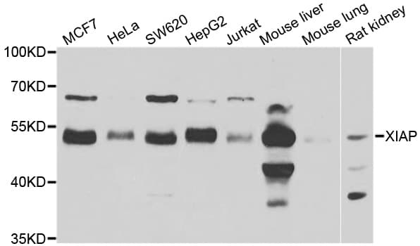 Polyclonal Rabbit anti-Human XIAP Antibody (IHC, IF, WB)