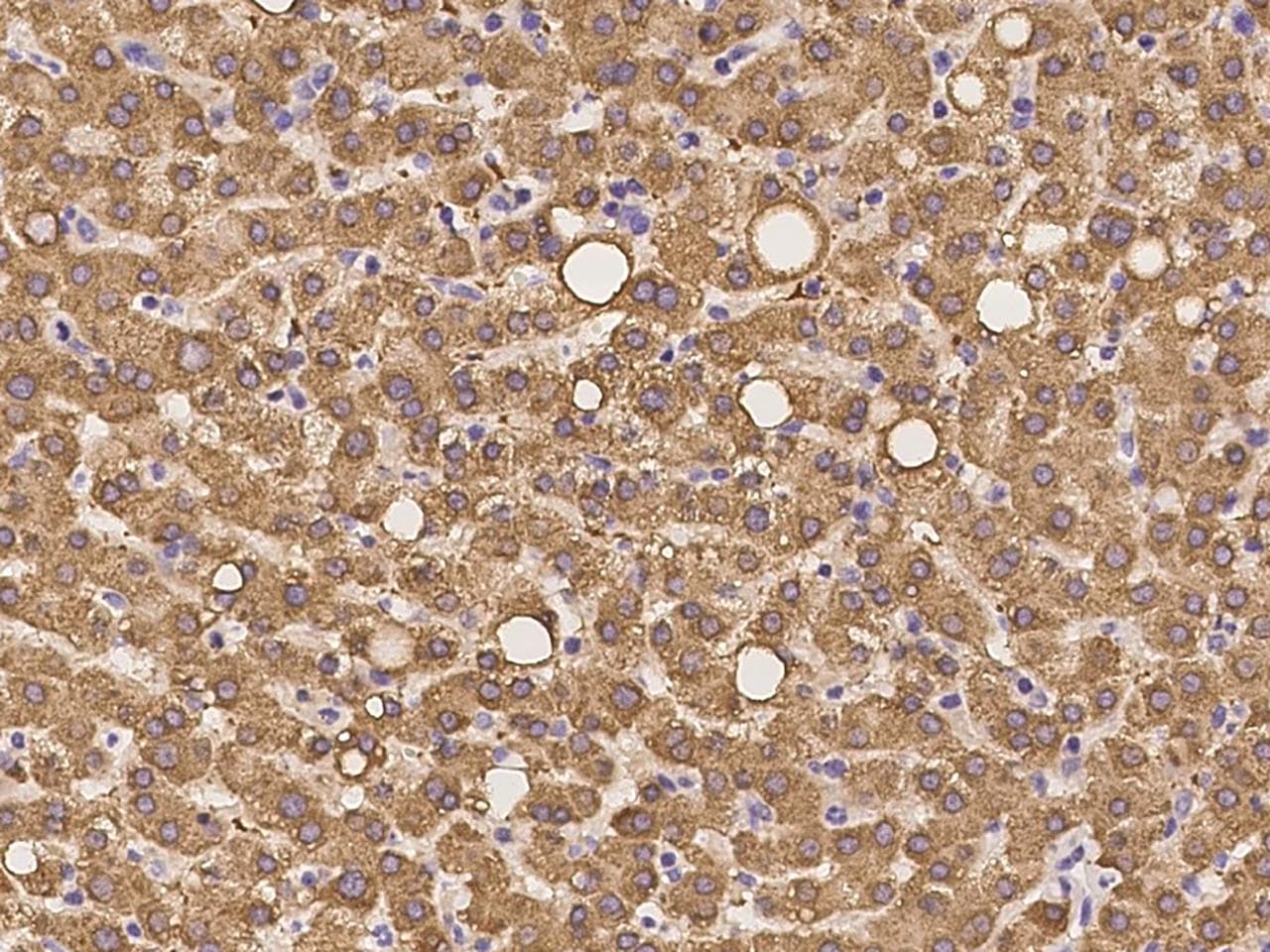 Polyclonal Rabbit anti-Human SHMT / SHMT1 Antibody (IHC, IF)