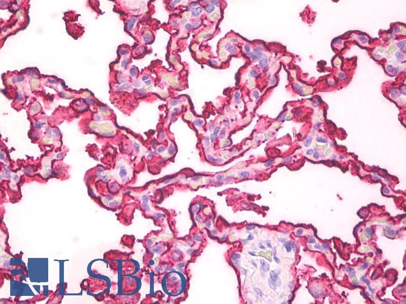 PathPlus™ EMA / MUC1 Antibody (clone 214D4)