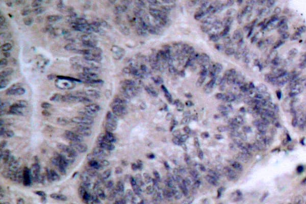 Polyclonal Rabbit anti-Human CHUK / IKKA / IKK Alpha Antibody (Met17, IHC, WB)