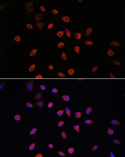 Polyclonal Rabbit anti-Human TG737 / IFT88 Antibody (IF, WB)
