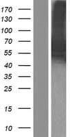 CAMKK2 Protein (Over-Expression Lysate Myc-DDK (Flag))