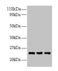 IHC-plus™ LCN2 / Lipocalin 2 / NGAL Antibody (aa1-198)