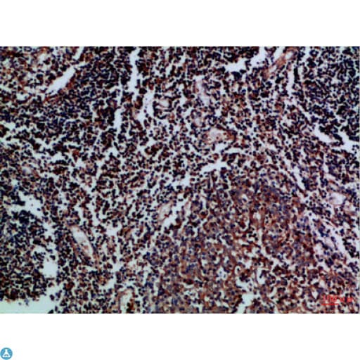 CD27L / CD70 Antibody