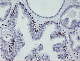 MEIS3 Antibody (aa1-261, clone OTI3E12, Carrier-free)