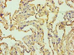 MSLN / Mesothelin Antibody (aa37-296)