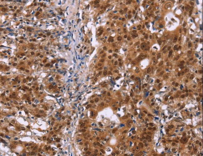 CBX3 / HP1 Gamma Antibody
