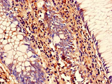 Polyclonal Rabbit anti-Human SENP1 Antibody (IHC, IF, WB)