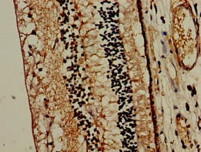 Polyclonal Rabbit anti-Human MTNR1B / MT2 Antibody (IHC, IF)