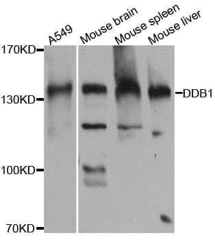 Polyclonal Rabbit anti-Human DDB1 Antibody (IHC, WB)