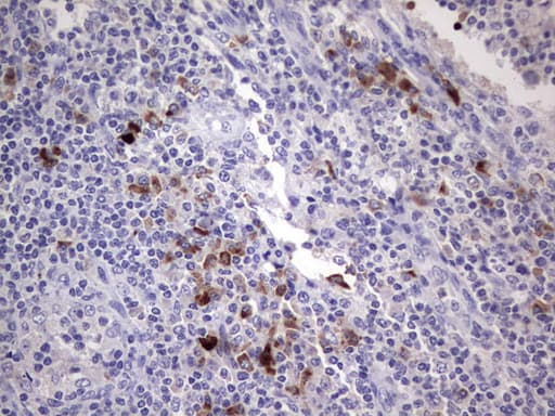 RSPO1 / RSPO Antibody (aa21-263, clone OTI11A9)