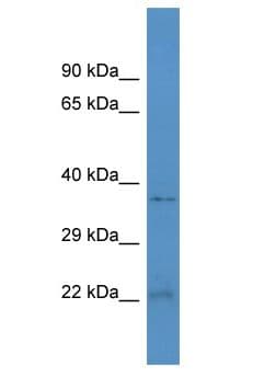 HEBP2 Antibody (aa19-68)