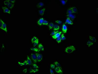 SPRY1 / Sprouty 1 Antibody