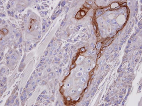 COT / CROT Antibody (aa140-462)
