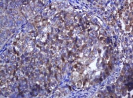 Monoclonal Mouse anti-Human TCL / RHOJ Antibody (clone OTI5F5, IHC, WB)