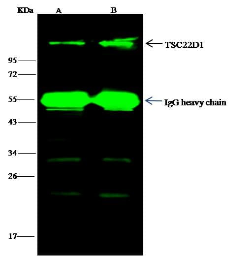 Polyclonal Rabbit anti-Human TSC22D1 / TSC22 Antibody (Preservative Free, WB)