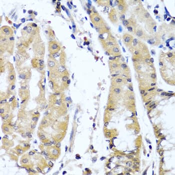 COL9A1 / Collagen IX Antibody