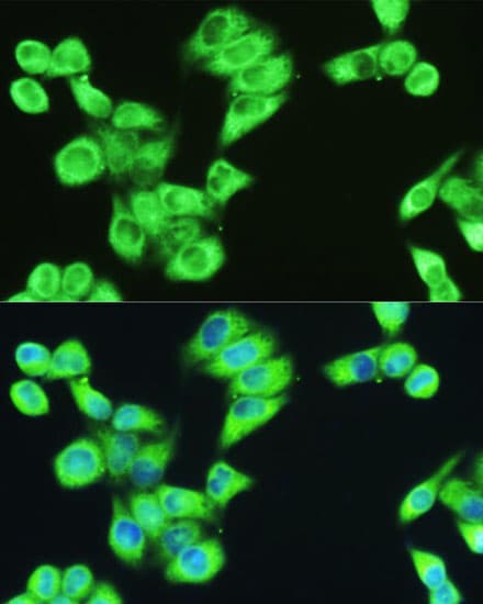 SERPINE1 / PAI-1 Antibody
