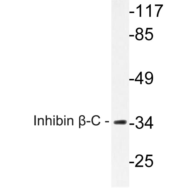 Polyclonal Rabbit anti-Human INHBC Antibody (aa80-129, IHC, WB)
