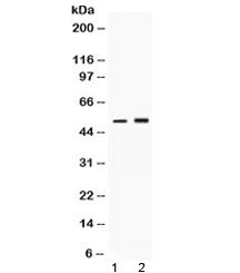 Polyclonal Rabbit anti-Human SERPINA1 / Alpha 1 Antitrypsin Antibody (WB)