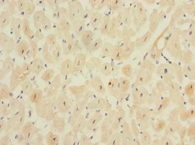 Polyclonal Rabbit anti-Human MPPED1 Antibody (IHC)