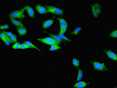 Polyclonal Rabbit anti-Human TBCB / CKAP1 Antibody (IHC, WB)