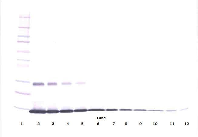 CSF2 / GM-CSF Antibody (Biotin)