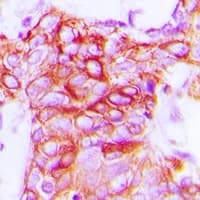 Polyclonal Rabbit anti-Human GPCR6 / GPR101 Antibody (C-Terminus, IHC, IF, WB)