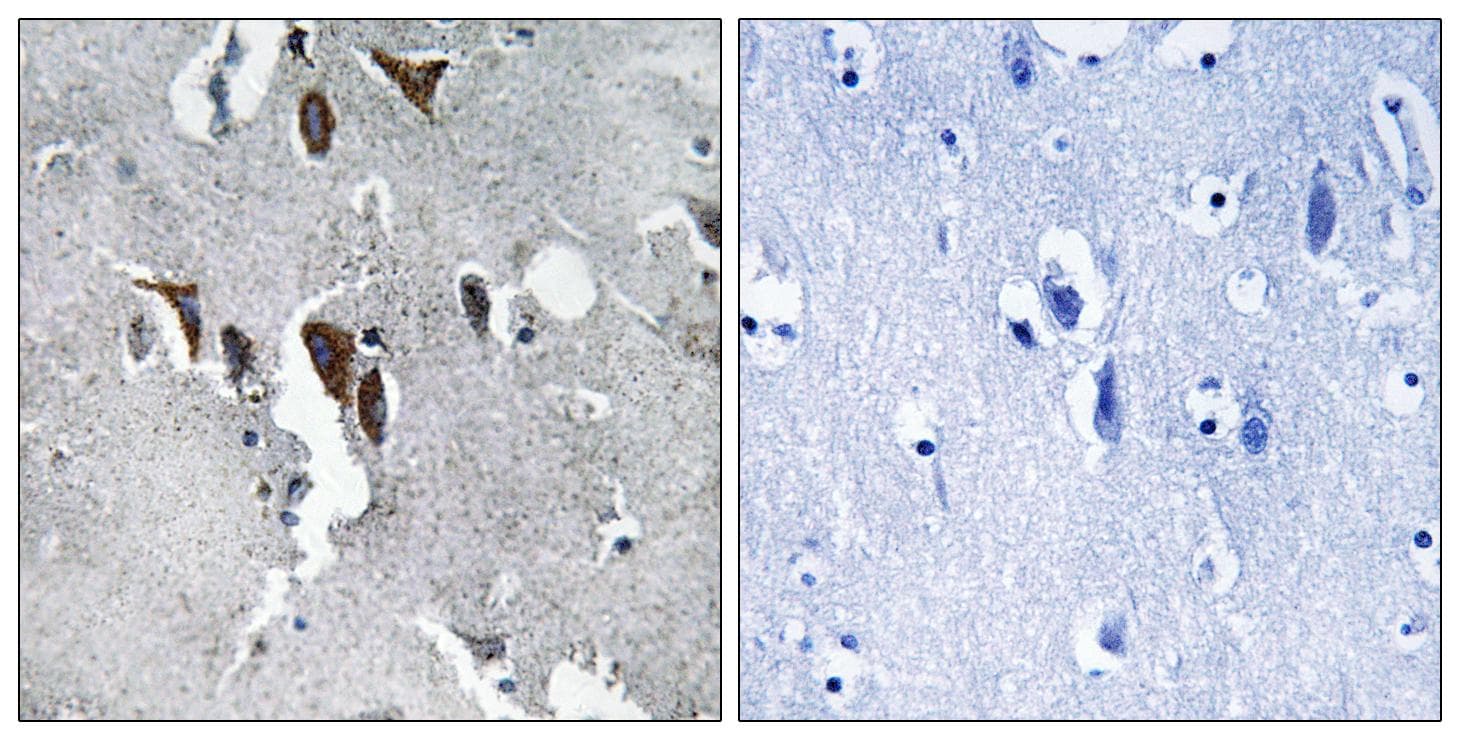 HELO1 / ELOVL5 Antibody