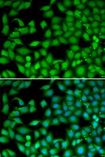 RTKN / Rhotekin Antibody