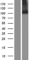 ADAMTSL2 Protein (Over-Expression Lysate Myc-DDK (Flag))