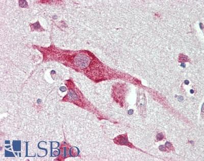 IHC-plus™ PA2G4 / EBP1 Antibody (aa345-394)