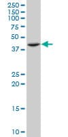 Monoclonal Mouse anti-Human ST3GAL4 / ST3Gal IV Antibody (clone 1F4, WB)