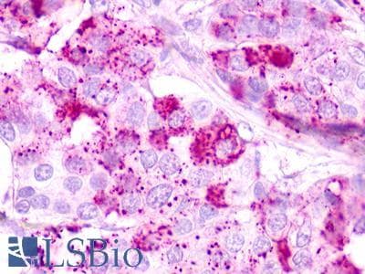 PathPlus™ GPR62 Antibody (Cytoplasmic Domain)