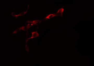 COL6A2 / Collagen VI Alpha 2 Antibody