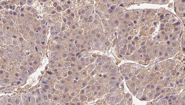 Polyclonal Rabbit anti-Human CATSPER4 Antibody (IHC, WB)
