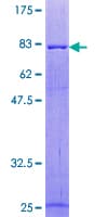 Human PTPN11 / SHP-2 / NS1 Protein (Recombinant GST)