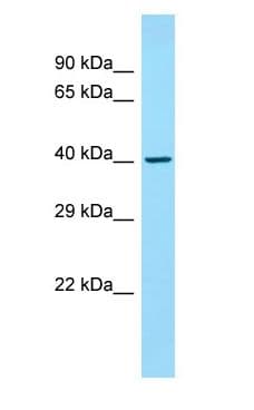 CDK5R2 Antibody (aa76-125)
