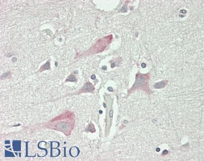 IHC-plus™ Polyclonal Rabbit anti-Human KCNQ4 Antibody (C-Terminus, IHC, WB)