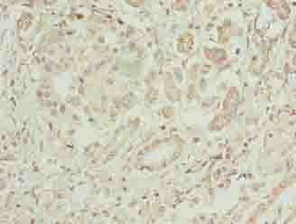 Polyclonal Rabbit anti-Human ERO1LB Antibody (IHC, WB)