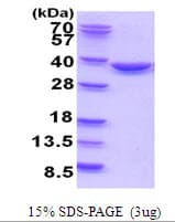 Human TATDN1 Protein (Recombinant His)