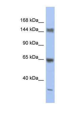 ATXN2 / SCA2 / Ataxin-2 Antibody (C-Terminus, Biotin)