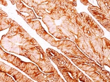 Cytokeratin 5+8 Antibody (clone C-50, Ready-to-Use)