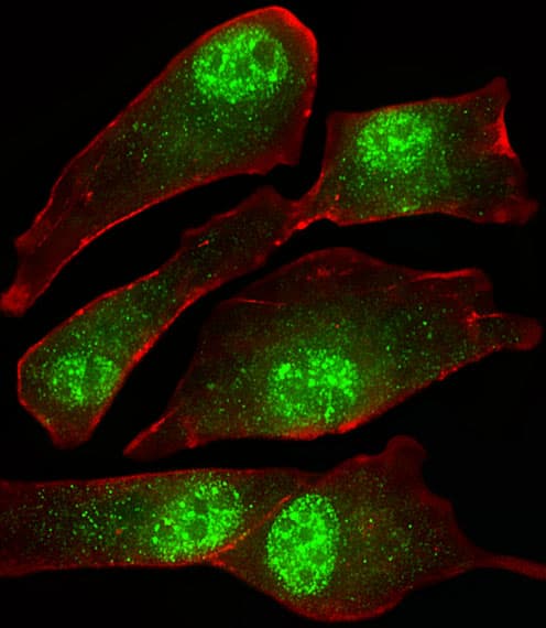 MORC2 Antibody (aa828-862)
