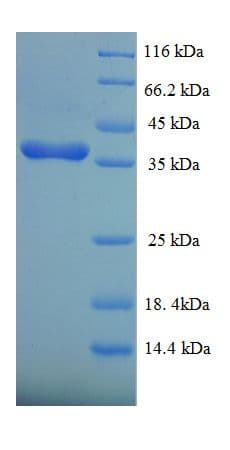 Human DUSP26 / MKP8 Protein (Recombinant His-SUMO)