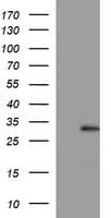 Placental Lactogen Antibody (clone OTI2E8)