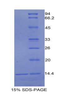 Rat UCN / Urocortin Protein (Recombinant His)