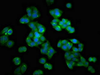 Polyclonal Rabbit anti-Human HMMR / CD168 / RHAMM Antibody (IHC, IF)