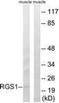 IHC-plus™ Polyclonal Rabbit anti-Human RGS1 Antibody (aa118-167, IHC, WB)