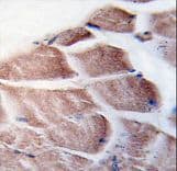 RPS6KA3 / RSK2 Antibody (aa13-42)